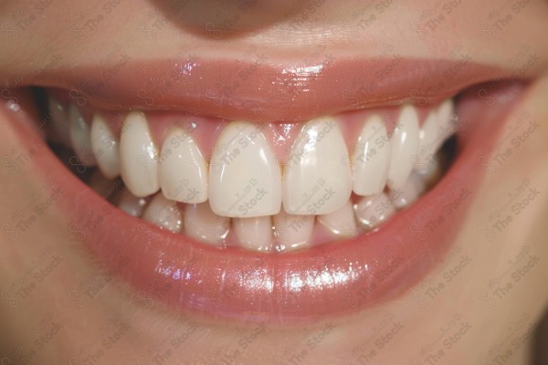 Lady's smile - teeth.