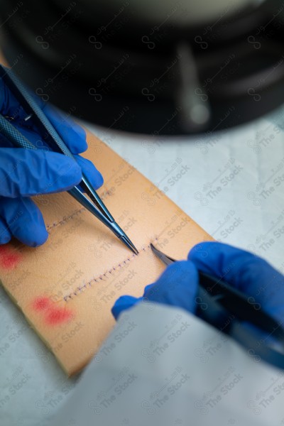 A picture of a group of medical tools used in skin suturing